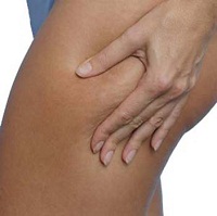 Rapid-Weight-Loss-Centers - Now to Lose Cellulite with Diet and Exercise
