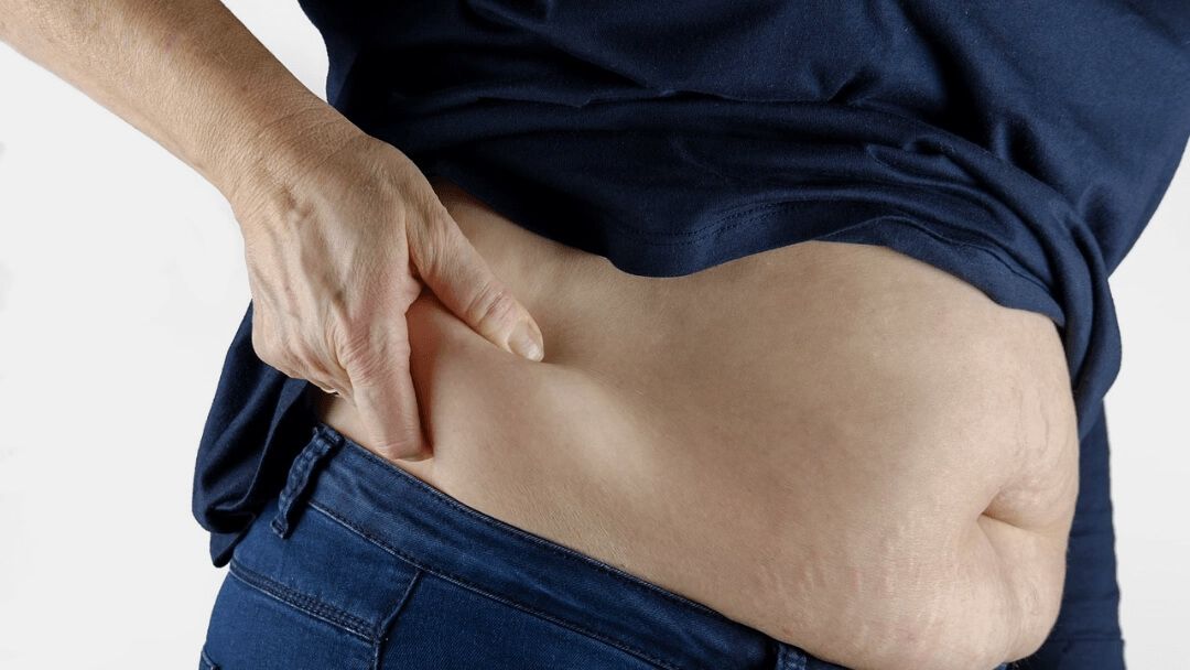 A person pinching stubborn abdominal fat, illustrating the belly and waist fat addressed by Dr. Sattele's HCG weight-loss program at Rapid Weight Loss Centers in the Pee Dee and Grand Strand region of South Carolina.