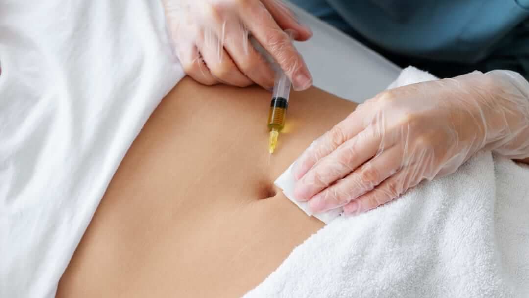 Mesotherapy provides targeted fat reduction for love handles and belly fat through minimally invasive injections that dissolve localized fat deposits. Dr. Sattele's Rapid Weight Loss & Esthetics Centers customizes mesotherapy treatments to help patients achieve body contours that diet and exercise alone cannot reach.